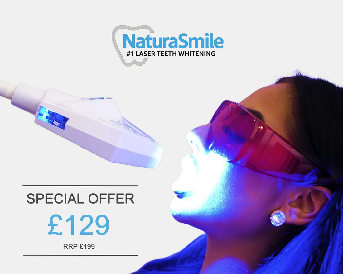 Cardiff Laser Teeth Whitening